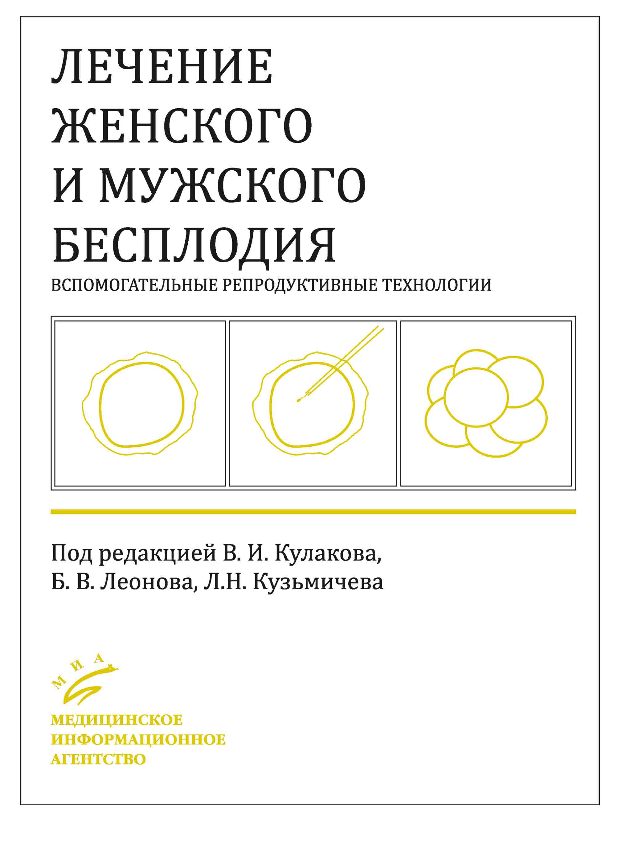 Лечение женского и мужского бесплодия. Вспомогательные репродуктивные технологии. Под ред. Кулакова В.И.