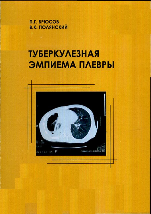 Туберкулезная эмпиема плевры. . Брюсов П.Г., Полянский В.К..