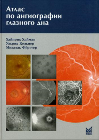 Атлас по ангиографии глазного дна. Хайман Х., Кельнер У., Ферстер М.