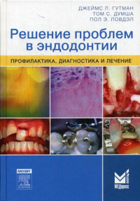 Решение проблем в эндодонтии. Профилактика, диагностика и лечение. 2-е изд. Гутман Дж., Думша Т.С., Ловдэл П.Э.