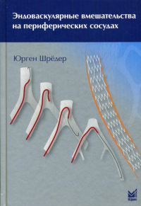 Эндоваскулярные вмешательства на периферических сосудах. Шредер Ю.