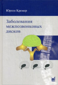 Заболевания межпозвонковых дисков. 2-е изд. . Кремер Ю.МЕДпресс-информ