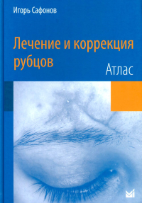 Сафонов И.. Лечение и коррекция рубцов. Атлас