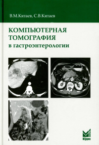 Компьютерная томография в гастроэнтерологии: руководство для врачей