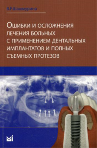 Ошибки и осложнения лечения больных с применением дентальных имплантов и полных съемных протезов. Шашмурина В.Р.