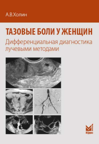 Холин А.В.. Тазовые боли у женщин. Дифференцианальная диагностика лучевыми методами