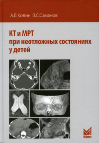 КТ и МРТ при неотложных состояниях у детей. . Холин А.В., Саманов В.С.МЕДпресс-информ