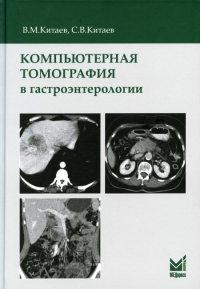 Компьютерная томография в гастроэнтерологии. 2-е изд. Китаев В.М., Китаев С.В.