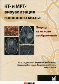 КТ- и МРТ- визуализация головного мозга. Подход на основе изображений. 2-е изд. Под ред. Румболдт З.