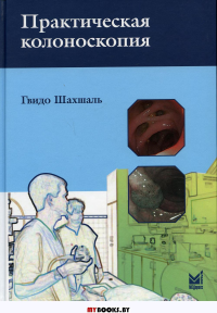 Практическая колоноскопия. Методика, рекомендации, советы и приемы. 2-е изд