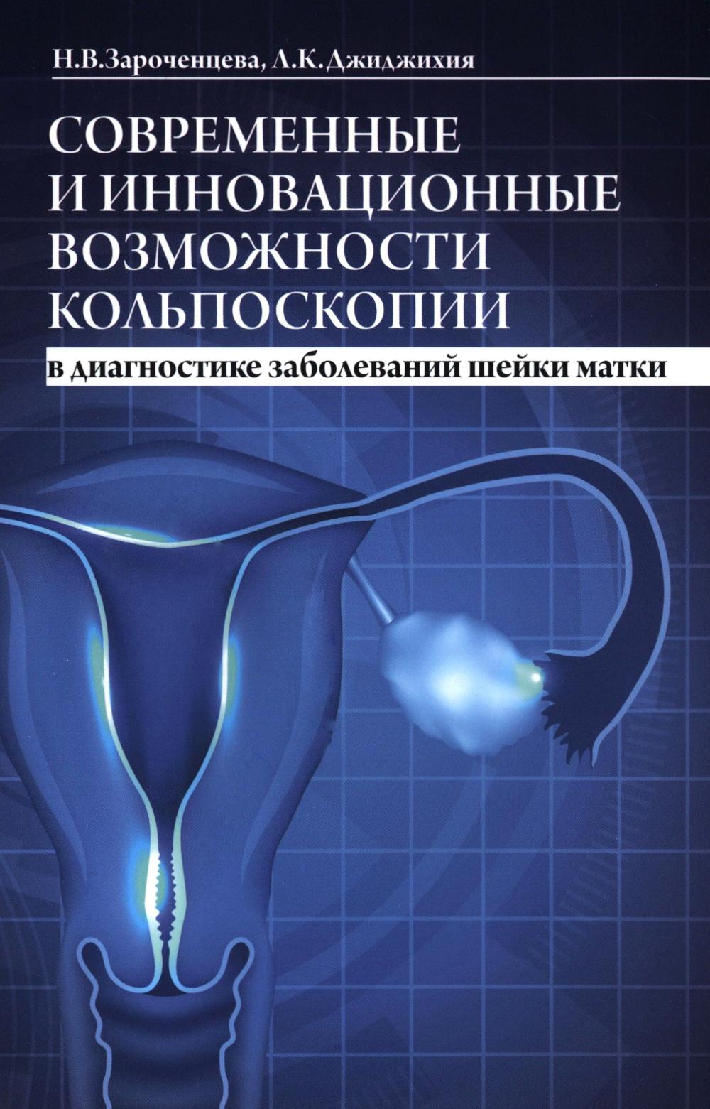 Современные и инновационные возможности кольпоскопии в диагностике заболеваний шейки матки. 2-е изд., доп.и перераб. Зароченцева Н.В., Джиджихия Л.К.