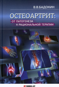 Остеоартрит: от патогенеза к рациональной терапии. Бадокин В.В.