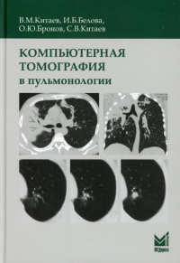 Компьютерная томография в пульмонологии. 3-е изд., доп. . Китаев В.М., Белова И.Б., Китаев С.В., Бронов О.ЮМЕДпресс-информ