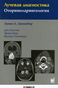 Лучевая диагностика. Оториноларингология. 4-е изд