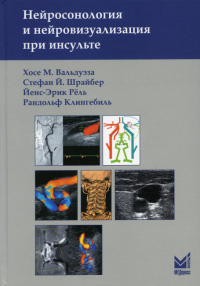 Нейросонология и нейровизуализация при инсульте. 2-е изд. Вальдуэза Х.М., Шрайбер С.Й., Рель Й.-Э.