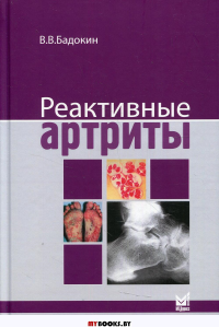 Реактивные артриты. Урогенитальные и постэнтероколитические. . Бадокин В.В.МЕДпресс-информ