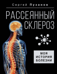 Рассеянный склероз. Моя история болезни. Пузанов С.И.