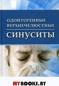 Одонтогенные верхнечелюстные синуситы. Кошель В.И., Кошель И.В., Сирак С.В.