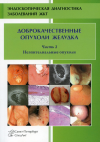 Доброкачественные опухоли желудка. Неэпителиальные  опухоли. Ч. 2: Учебно-методическое пособие. Кузин М.Н., Добронец В.В., Шкалова Л.В.