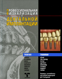 Профессиональная визуализация в дентальной имплантации