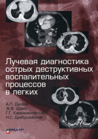 Лучевая диагностика острых деструктивных воспалительных процессов в легких