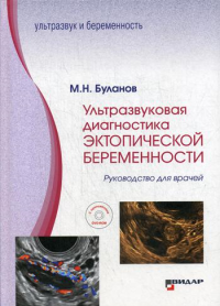 Ультразвуковая диагностика эктопической беременности: Руководство для врачей: с приложением DVD-ROM