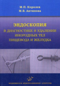 Эндоскопия в диагностике и удалении инородных тел пищевода и желудка