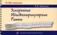 Ускоренные идиовентрикулярные ритмы: клинико-электрокардиографические особенности, систематизация по ЭКГ-характеристикам, дифференцирование с другими