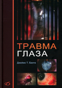 Травма глаза