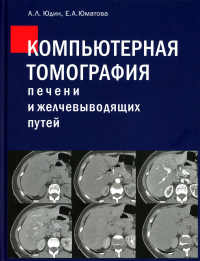 Компьютерная томография печени и желчевыводящих путей: практическое руководство. Юдин А., Юматова Е.