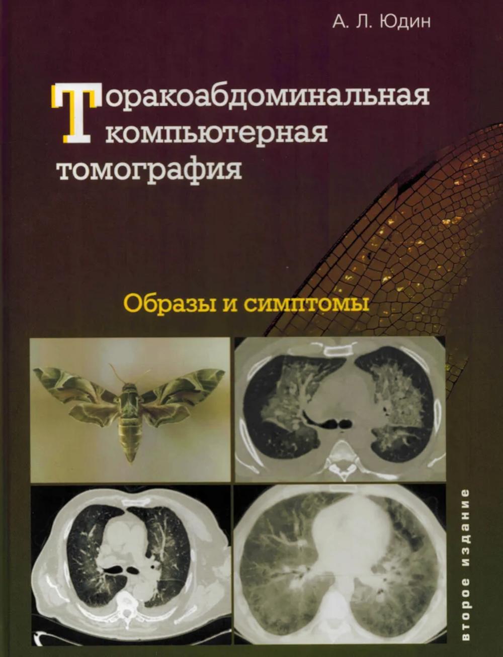 Торакоабдоминальная компьютерная томография. Образы и симптомы. Юдин А.
