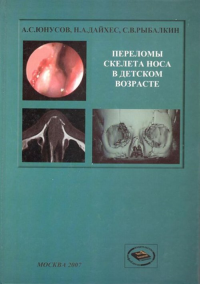 Переломы костей носа в детском возрасте. Юнусов А.С., Дайхес Н.А., Рыбалкин С.В.