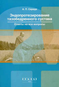 Середа А.П.. Эндопротезирование тазобедренного сустава. Ответы на все вопросы