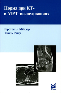 Норма при КТ- и МРТ-исследованиях. 6-е изд. Меллер Т.Б., Райф Э.