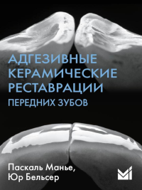 Бельсер Ю., Манье П.. Адгезивные керамические реставрации передних зубов. 4-е изд