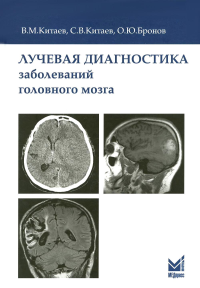 Лучевая диагностика заболеваний головного мозга. Китаев В.М., Китаев С.В., Бронов О.Ю.