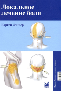 Локальное лечение боли. 11-е изд. Фишер Ю.