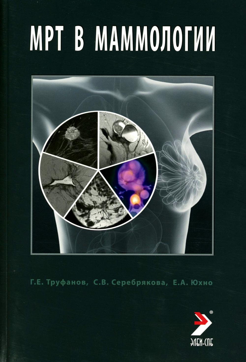 МРТ в маммологии: руководство для врачей. Труфанов Г.Е., Серебрякова С.В., Юхно Е.А.
