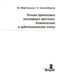 Точная припасовка несъемных протезов. Клинические и зуботехнические этапы