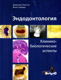 Рукуччи Д., Сикейра Ж.. Эндодонтология. Клинико-биологические аспекты