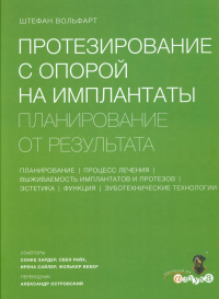 Протезирование с опорой на имплантаты. Планирование от результата