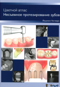 Несъемное протезирование зубов. Цветной атлас