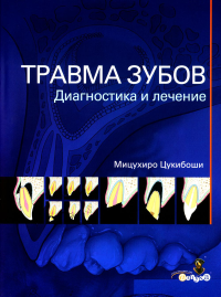 Цукибоши М.. Травма зубов. Диагностика и лечение