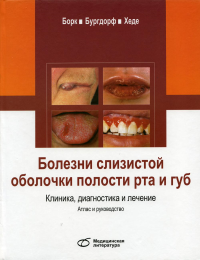 Болезни слизистой оболочки полости рта и губ. Клиника, диагностика и лечение. Атлас и руководство