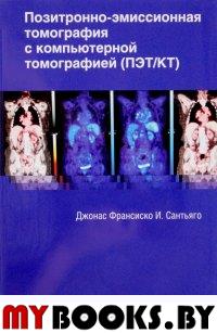 Позитронно-эмиссионная томография с компьютерной томографией. . Сантьяго Дж.И..