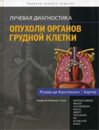 Лучевая диагностика. Опухоли органов грудной клетки. Розадо-де-Кристенсон М.Л., Картер Б.В