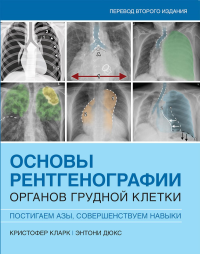 Основы рентгенографии органов грудной клетки