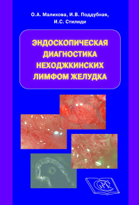 Эндоскопическая диагностика неходжкинских лимфом желудка. . Малихова О.А., Поддубная И.В., Стилиди И.С..