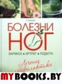 Болезни ног: варикоз, артрит, подагра. Алешина