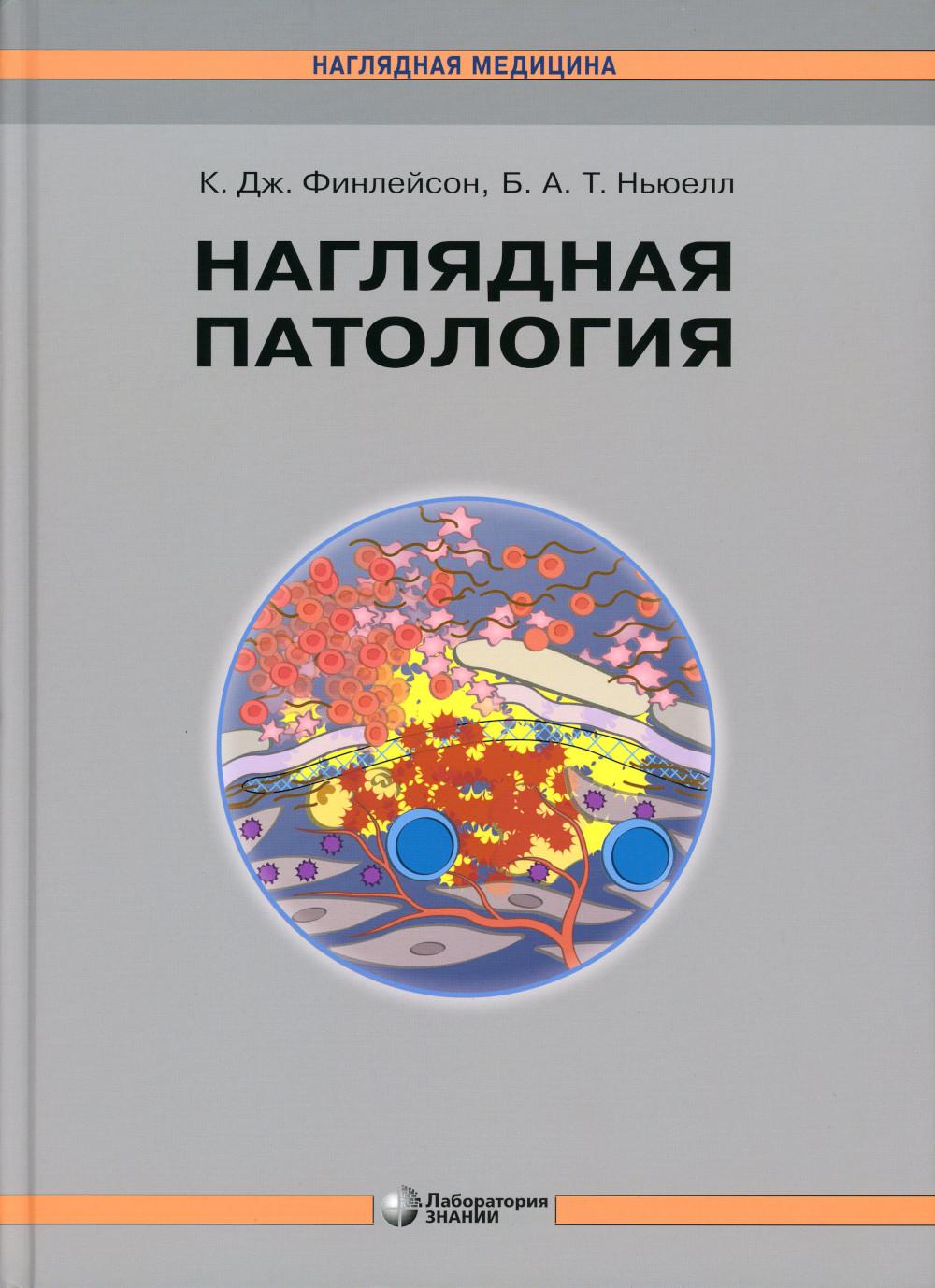 Наглядная патология. 2-е изд. Финлейсон К.Дж., Ньюелл Б.А.Т